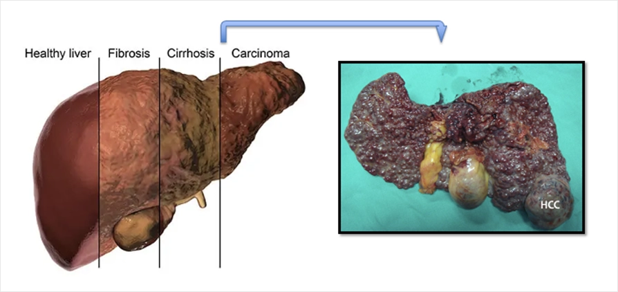 Karaciğere Övgü 4
